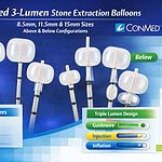 ConMed 3-Lumen Stone Extraction Balloons — Above & Below Configurations (8.5mm, 11.5mm, 15mm)