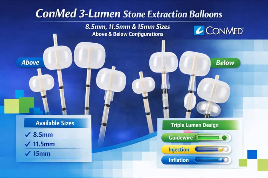 ConMed 3-Lumen Stone Extraction Balloons — Above & Below Configurations (8.5mm, 11.5mm, 15mm)